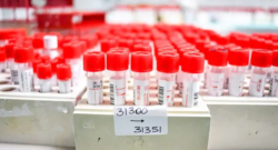 Coronavirus, al Cotugno tampone super veloce: risultato in 20 minuti   continua su: https://napoli.fanpage.it/coronavirus-al-cotugno-tampone-super-veloce-risultato-in-20-minuti/ https://napoli.fanpage.it/